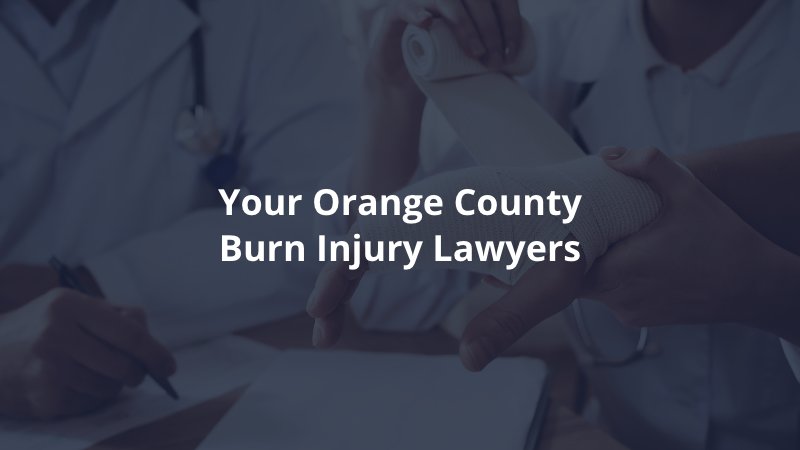 Orange County burn injury lawyer